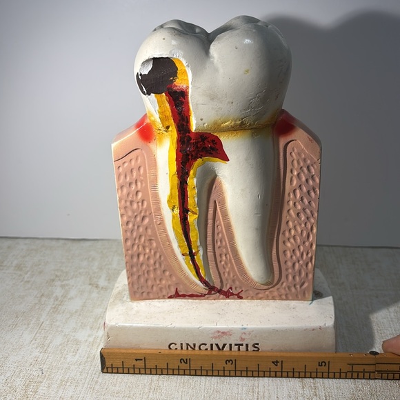 Procter & Gamble Vintage Tooth Model for Gingivitis 1960's (By Crest) - Picture 8 of 8
